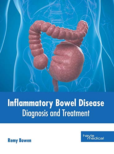 Inflammatory Bowel Disease: Diagnosis and Treatment - Retail Maharaj