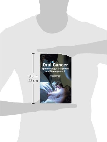 Oral Cancer: Epidemiology, Diagnosis and Management - Retail Maharaj
