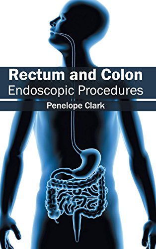 Rectum and Colon: Endoscopic Procedures - Retail Maharaj