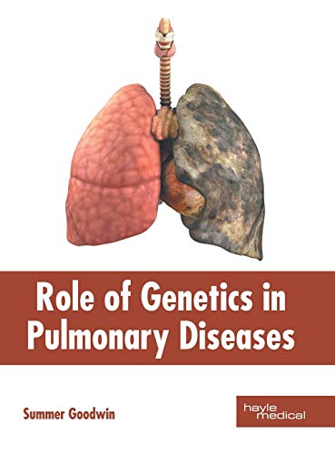 Role of Genetics in Pulmonary Diseases - Retail Maharaj