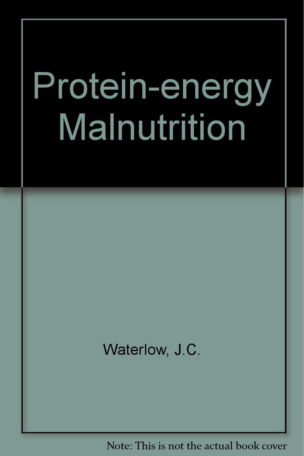 Protein-energy Malnutrition - Retail Maharaj