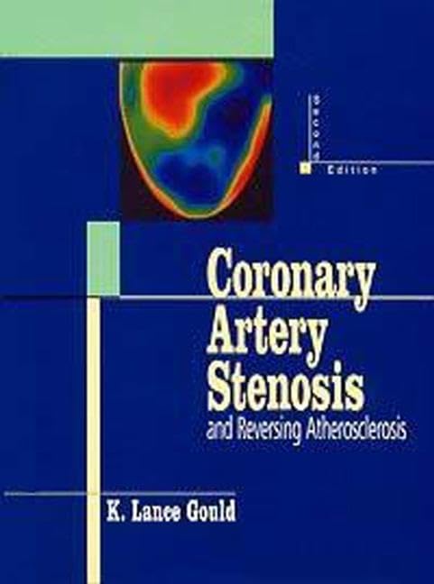 Coronary Artery Stenosis - Retail Maharaj