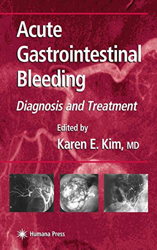 Acute Gastrointestinal Bleeding: Diagnosis and Treatment (Clinical Gastroenterology) - Retail Maharaj