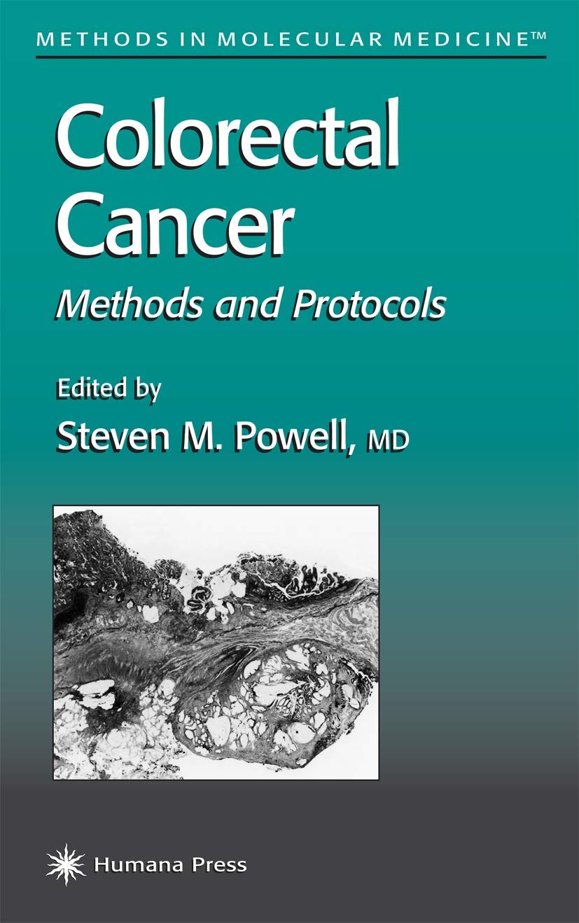 Colorectal Cancer Methods and Protocols - Retail Maharaj
