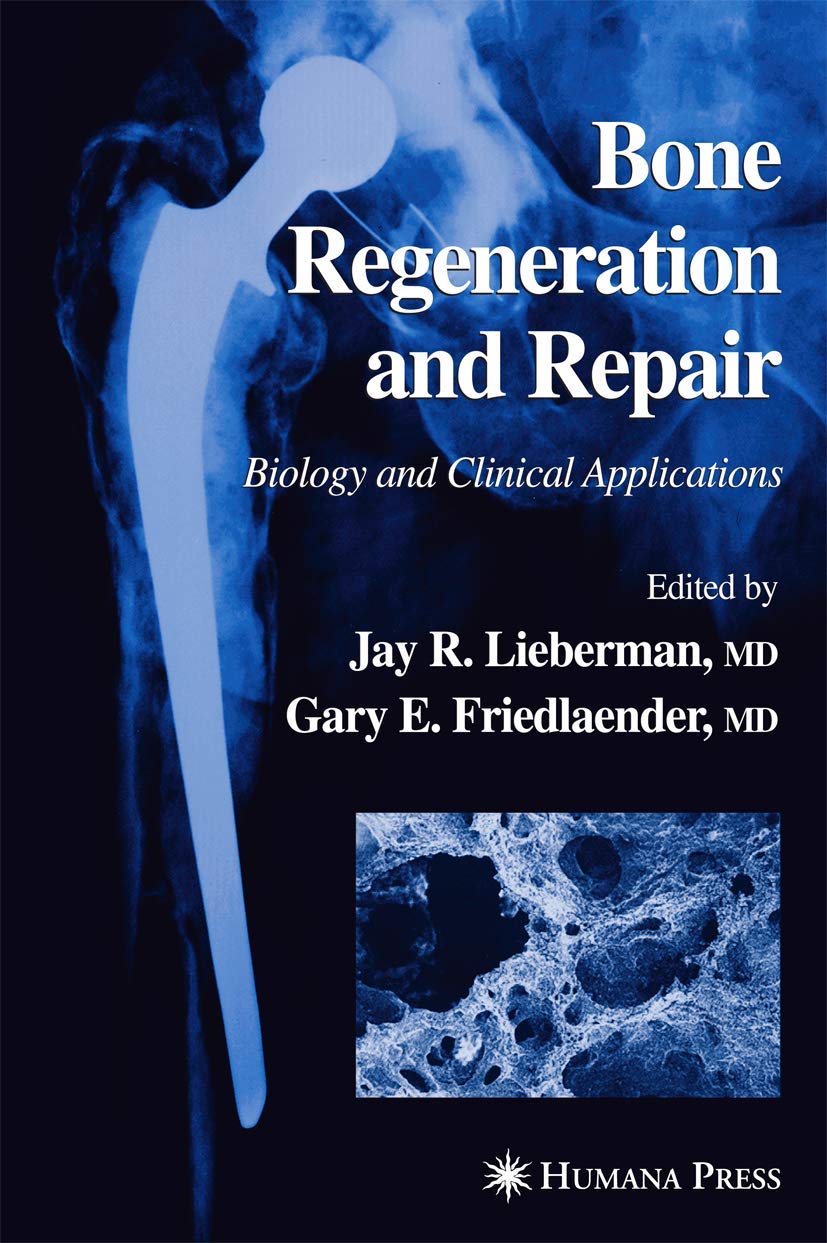 BONE REGENERATION AND REPAIR: Biology and Clinical Applications - Retail Maharaj
