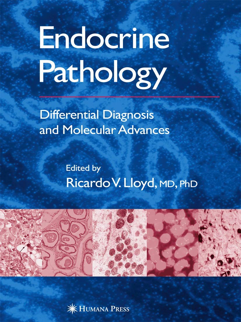 Endocrine Pathology: Differential Diagnosis and Molecular Advances - Retail Maharaj