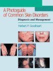 A Photo Guide of Common Skin Disorders: Diagnosis and Management - Retail Maharaj