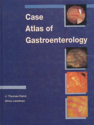 Case Atlas of Gastroenterlogy - Retail Maharaj