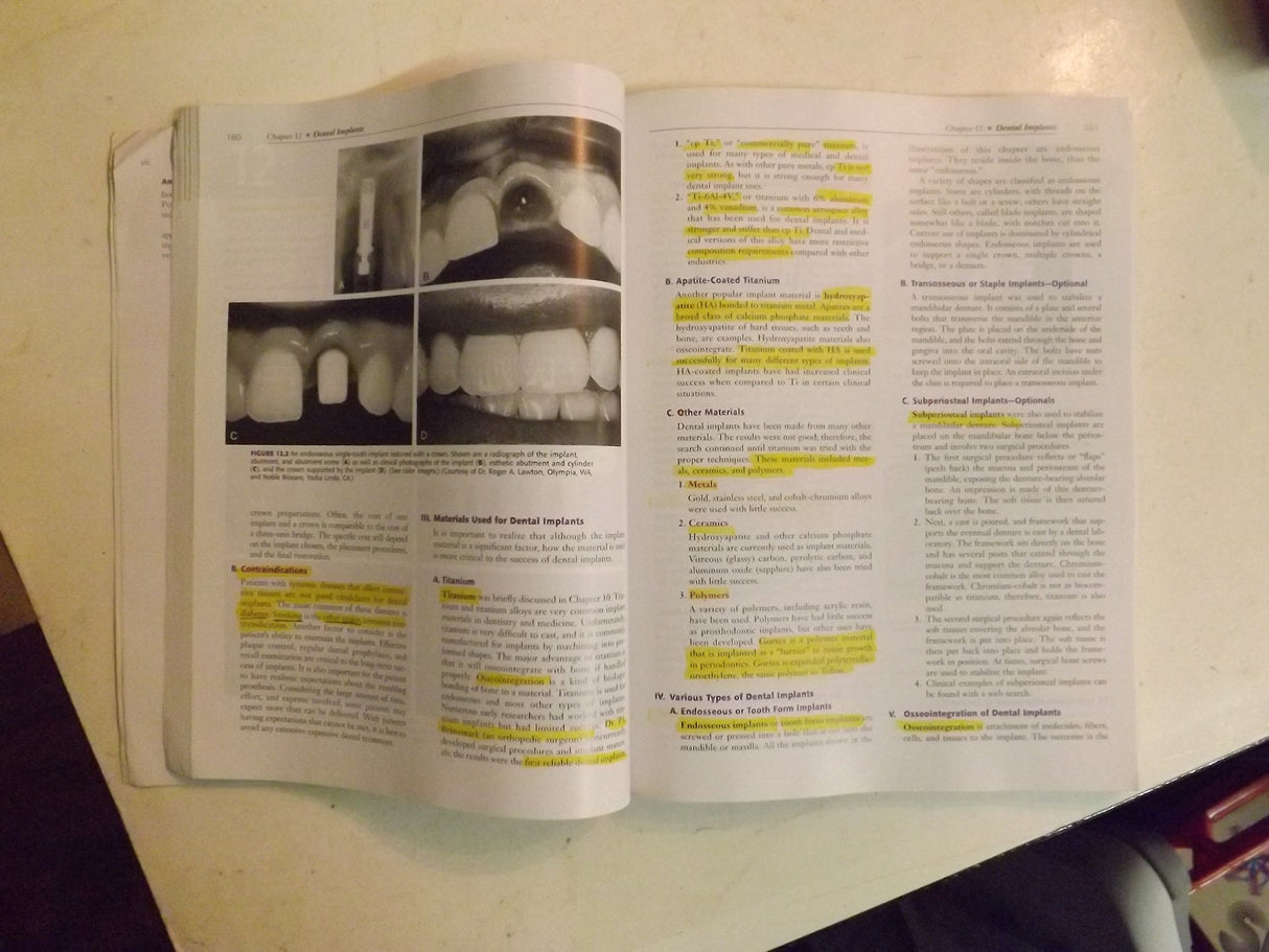 Clinical Aspects of Dental Materials: Theory, Practice, and Cases - Retail Maharaj