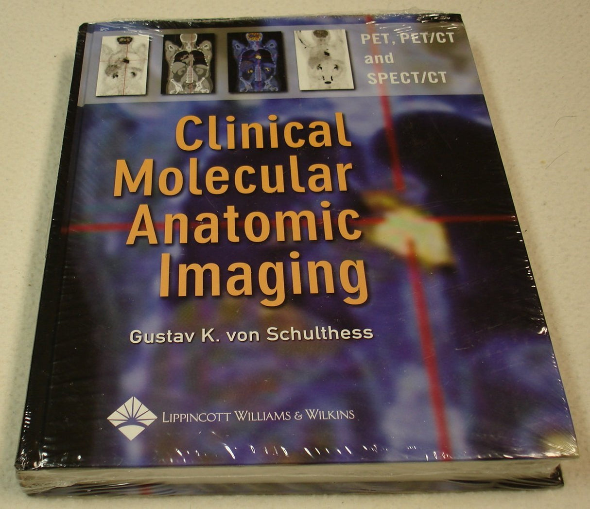 Clinical Molecular Anatomic Imaging: PET, PET/CT, and SPECT/CT - Retail Maharaj