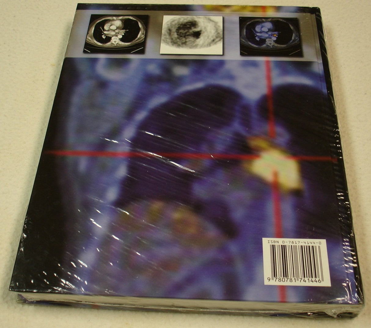 Clinical Molecular Anatomic Imaging: PET, PET/CT, and SPECT/CT - Retail Maharaj