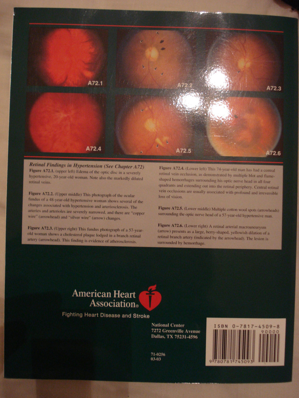 Hypertension Primer: The Essentials of High Blood Pressure - Retail Maharaj