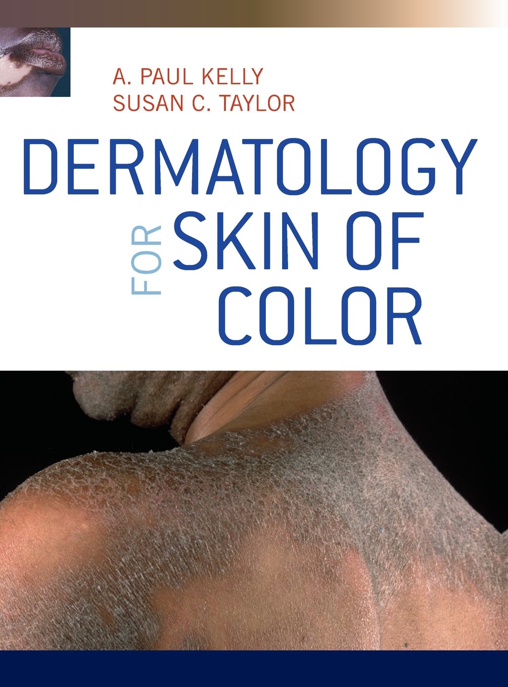 Dermatology for Skin of Color - Retail Maharaj