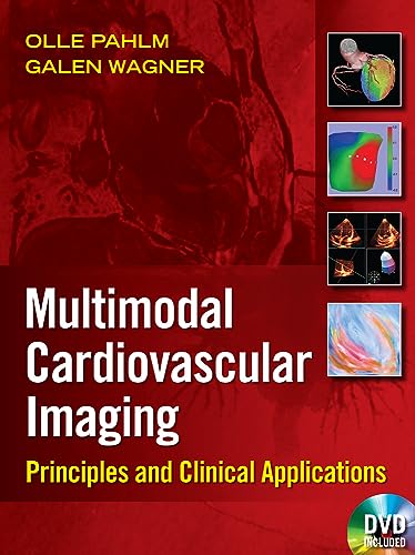 Multimodal Cardiovascular Imaging: Principles and Clinical Applications - Retail Maharaj