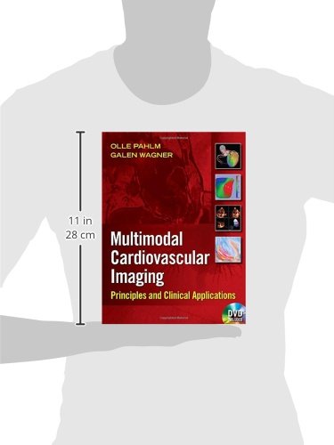 Multimodal Cardiovascular Imaging: Principles and Clinical Applications - Retail Maharaj