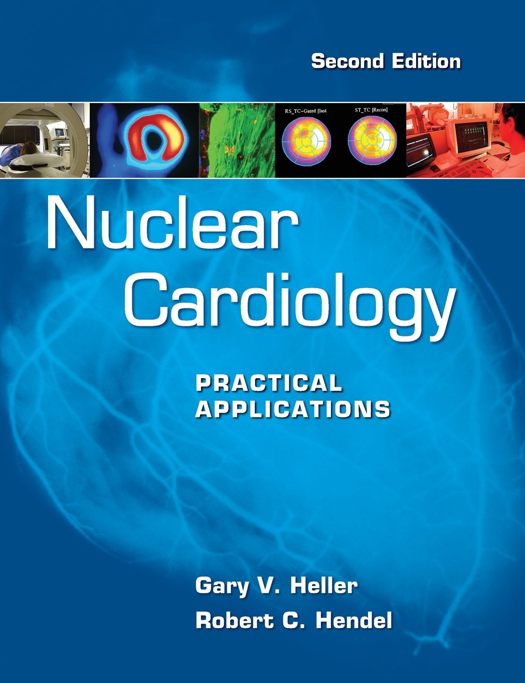 Nuclear Cardiology: Practical Applications, Second Edition - Retail Maharaj