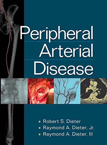 Peripheral Arterial Disease (INTERNAL MEDICINE) - Retail Maharaj