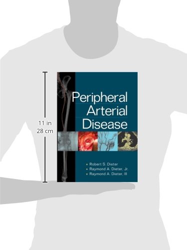Peripheral Arterial Disease (INTERNAL MEDICINE) - Retail Maharaj