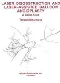 Laser Disobstruction and Laser-assisted Balloon Angioplasty - Retail Maharaj