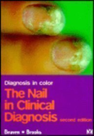 A Color Atlas of the Nail in Clinical Diagnosis - Retail Maharaj