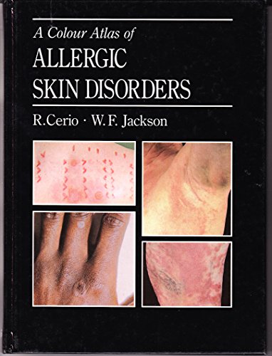 A Colour Atlas of Allergic Skin Disorders - Retail Maharaj