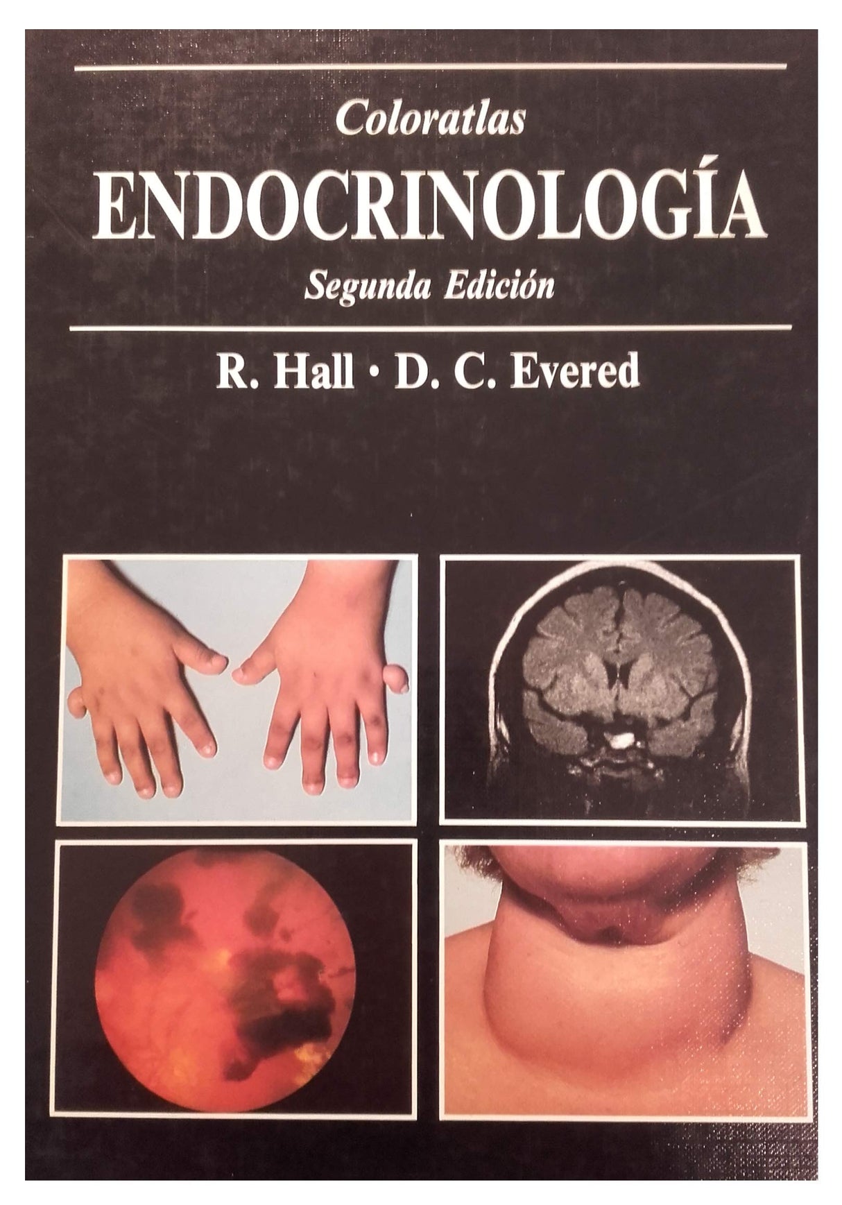 A Colour Atlas of Endocrinology - Retail Maharaj
