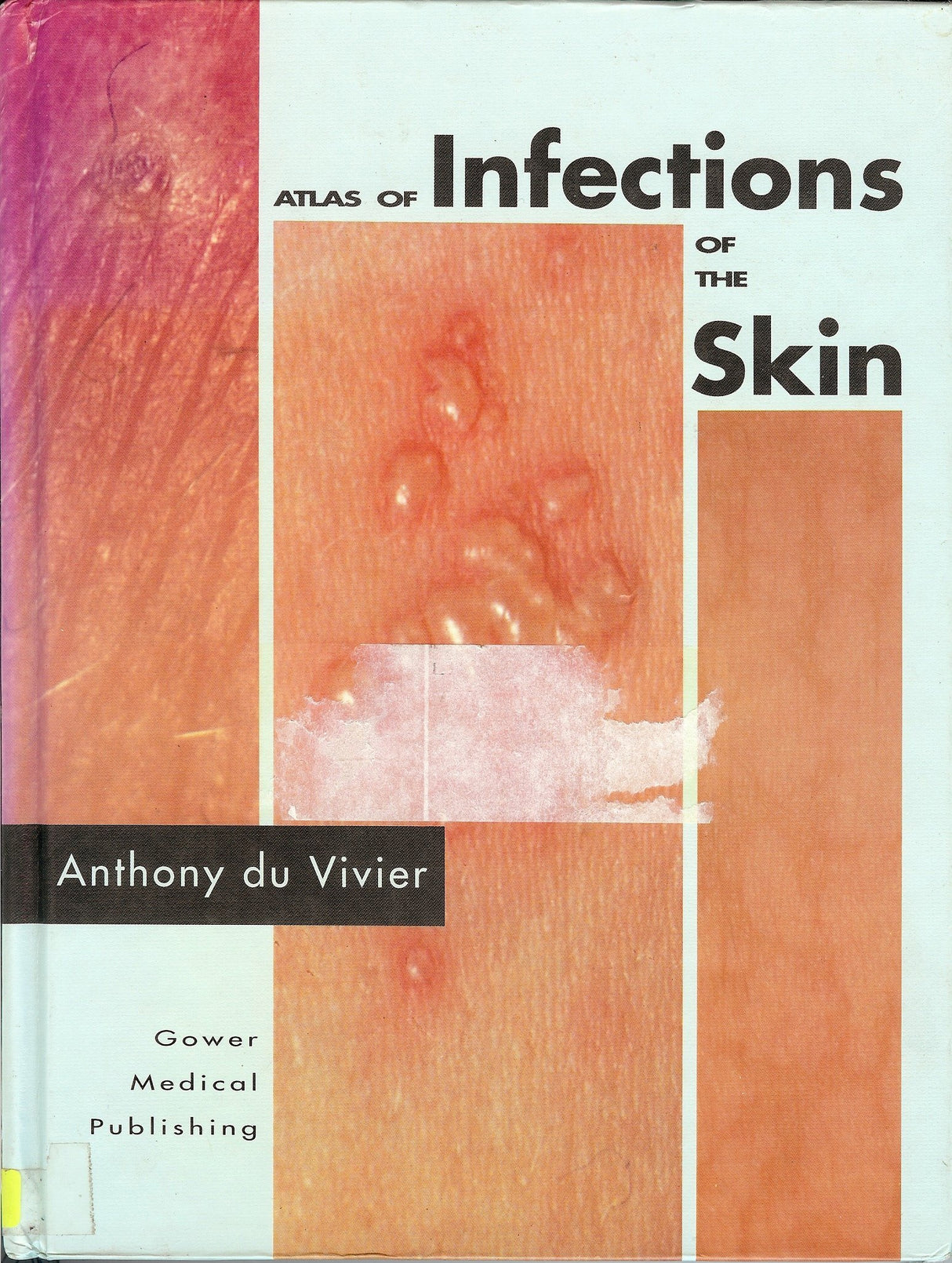 Atlas of Infections of the Skin - Retail Maharaj