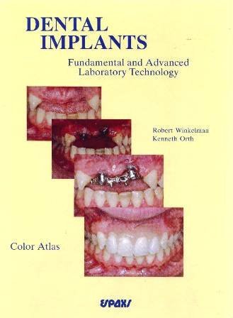 Dental Implants: Fundamental and Advanced Laboratory Technology - Retail Maharaj