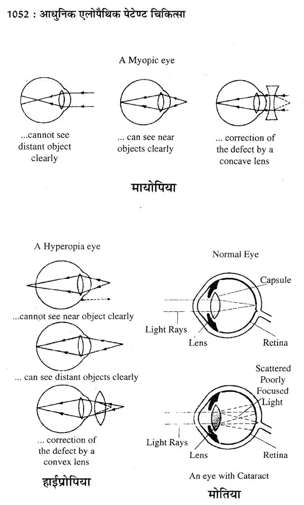 आधुनिक एलोपैथिक पेटेण्ट चिकित्सा चार्ट्स विद् मेटिरिया मेडिका - Modern Allopathic (Patent Medical Chart with Materia Medica) - Retail Maharaj