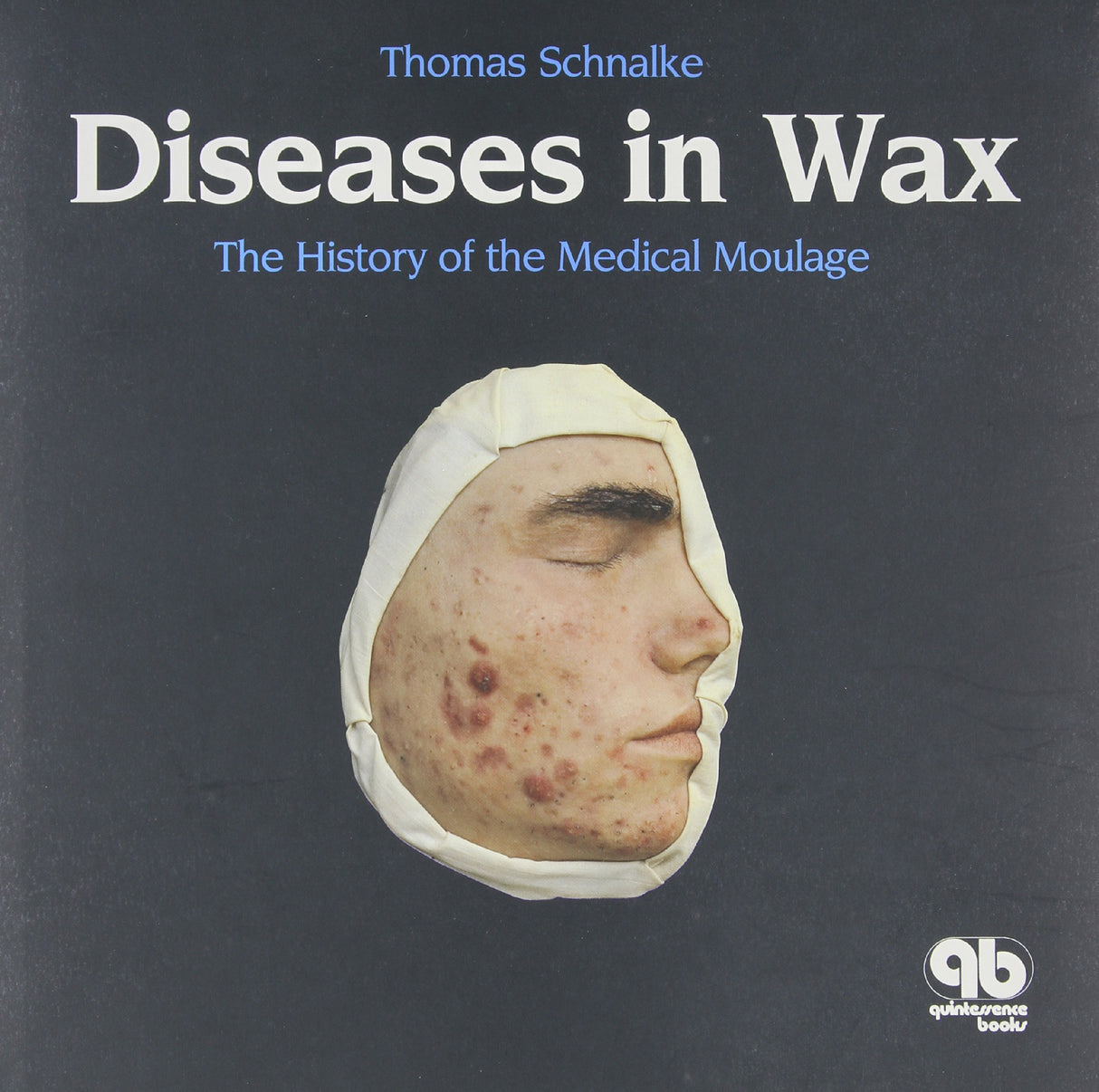 DISEASES IN WAX THE HISTORY OF THE MEDICAL MOULAGE (HB 1995) - Retail Maharaj