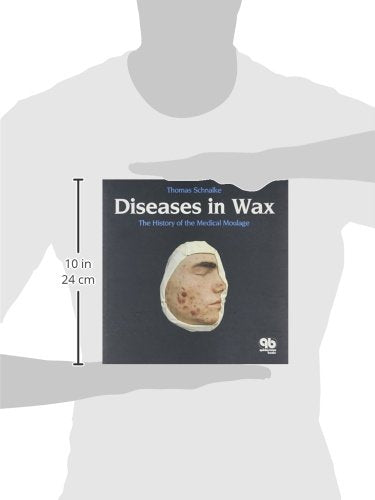 DISEASES IN WAX THE HISTORY OF THE MEDICAL MOULAGE (HB 1995) - Retail Maharaj