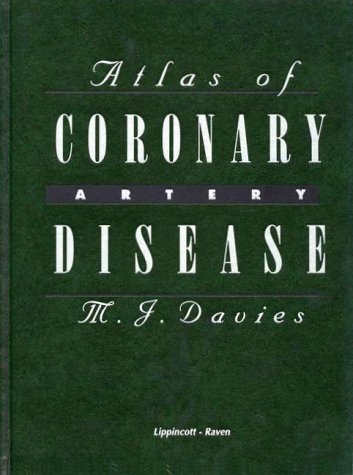 Atlas of Coronary Artery Disease - Retail Maharaj