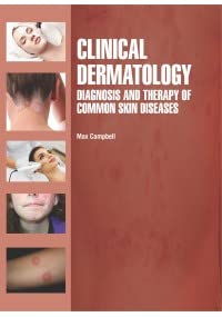 Clinical Dermatology: Diagnosis And Therapy Of Common Skin Diseases - Retail Maharaj