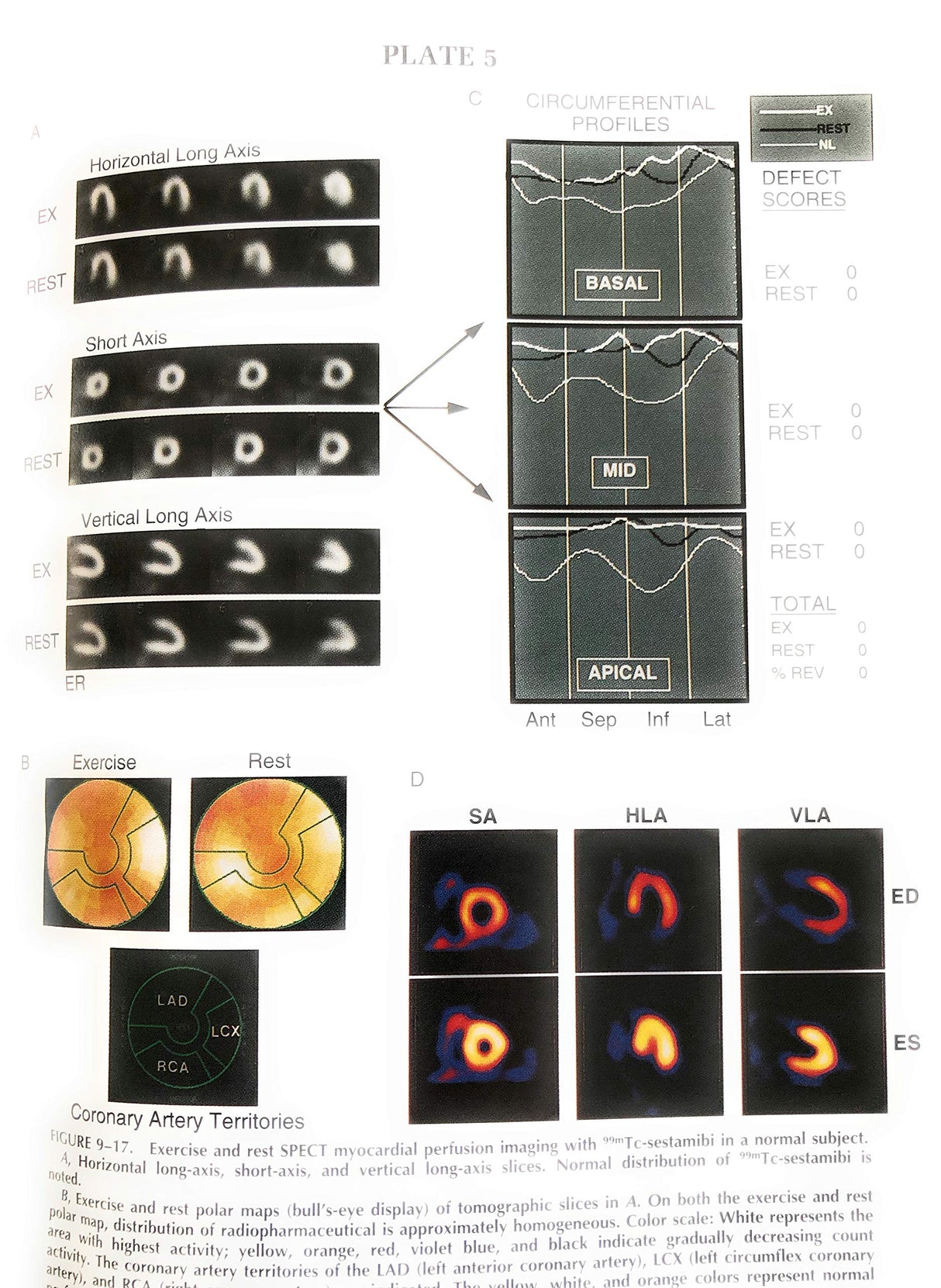 In 1v (Heart Disease: A Textbook of Cardiovascular Medicine) - Retail Maharaj