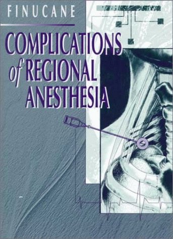 Complications of Regional Anesthesia - Retail Maharaj
