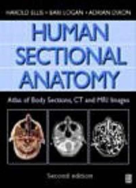 Human Sectional Anatomy, 2Ed: Atlas of Body Sections, CT and MRI Images - Retail Maharaj