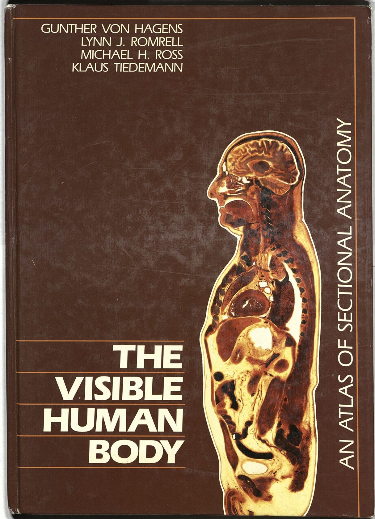 The Visible Human Body: Atlas of Sectional Anatomy - Retail Maharaj
