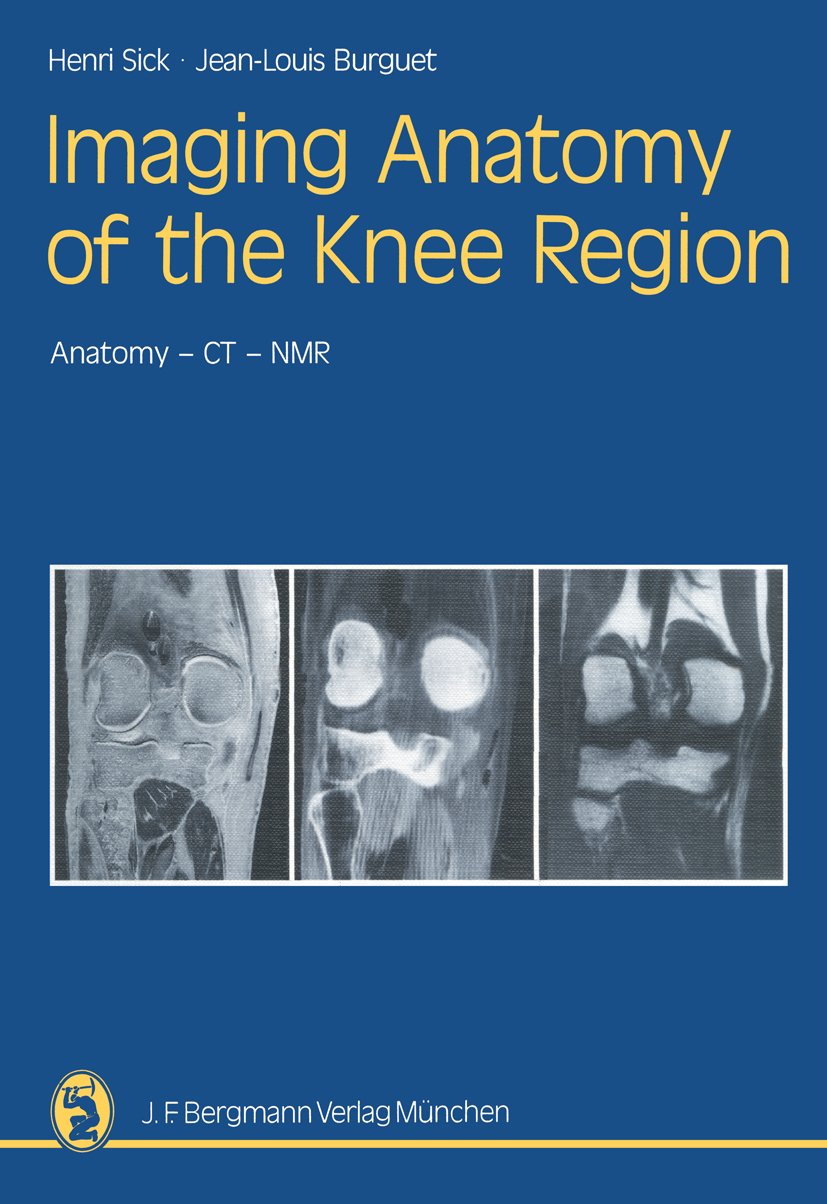 Imaging Anatomy of the Knee Region: Anatomy-CT-NMR Frontal Slices, Sagittal Slices, Horizontal Slices - Retail Maharaj