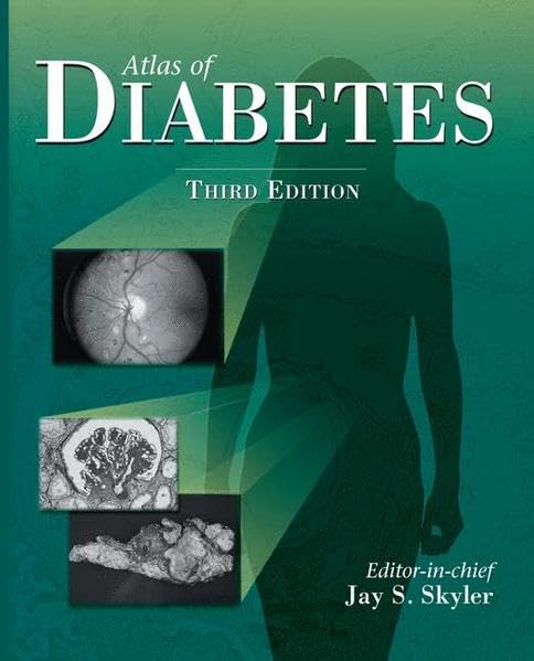 ATLAS OF DIABETES,3/E - Retail Maharaj
