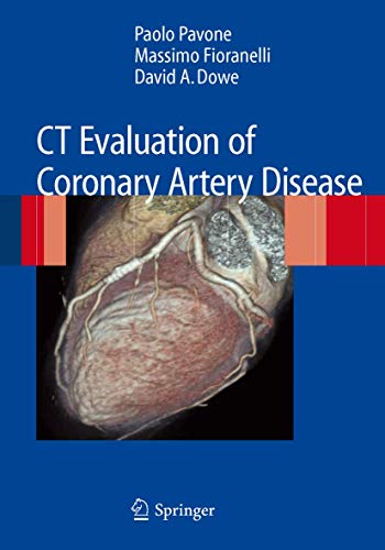 CT Evaluation of Coronary Artery Disease - Retail Maharaj