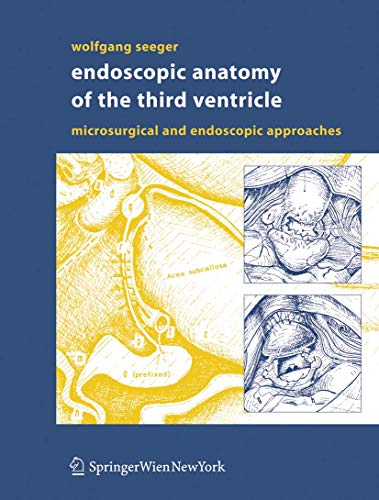 ENDOSCOPIC ANATOMY OF THE THIRD VENTRICLE (HB): Microsurgical and Endoscopic Approaches - Retail Maharaj