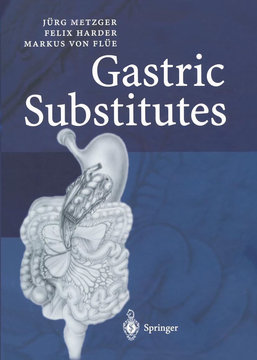 Gastric Substitutes - Retail Maharaj