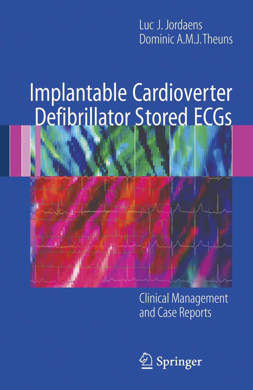 IMPLANTABLE CARDIOVERTER DEFIBRILLATOR STORED ECGS: CLINICAL MANAGEMENT AND CASE REPORTS - Retail Maharaj