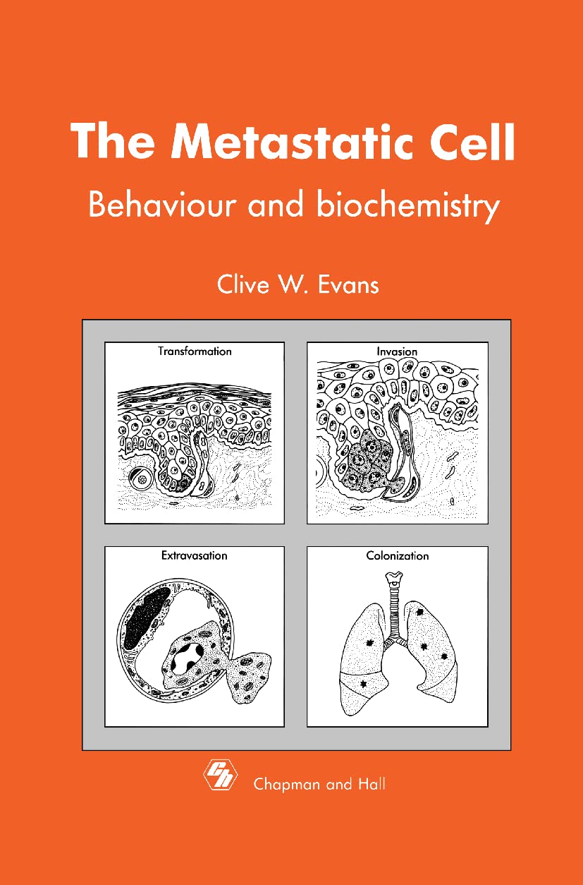Metastatic Cell: Behaviour and biochemistry - Retail Maharaj