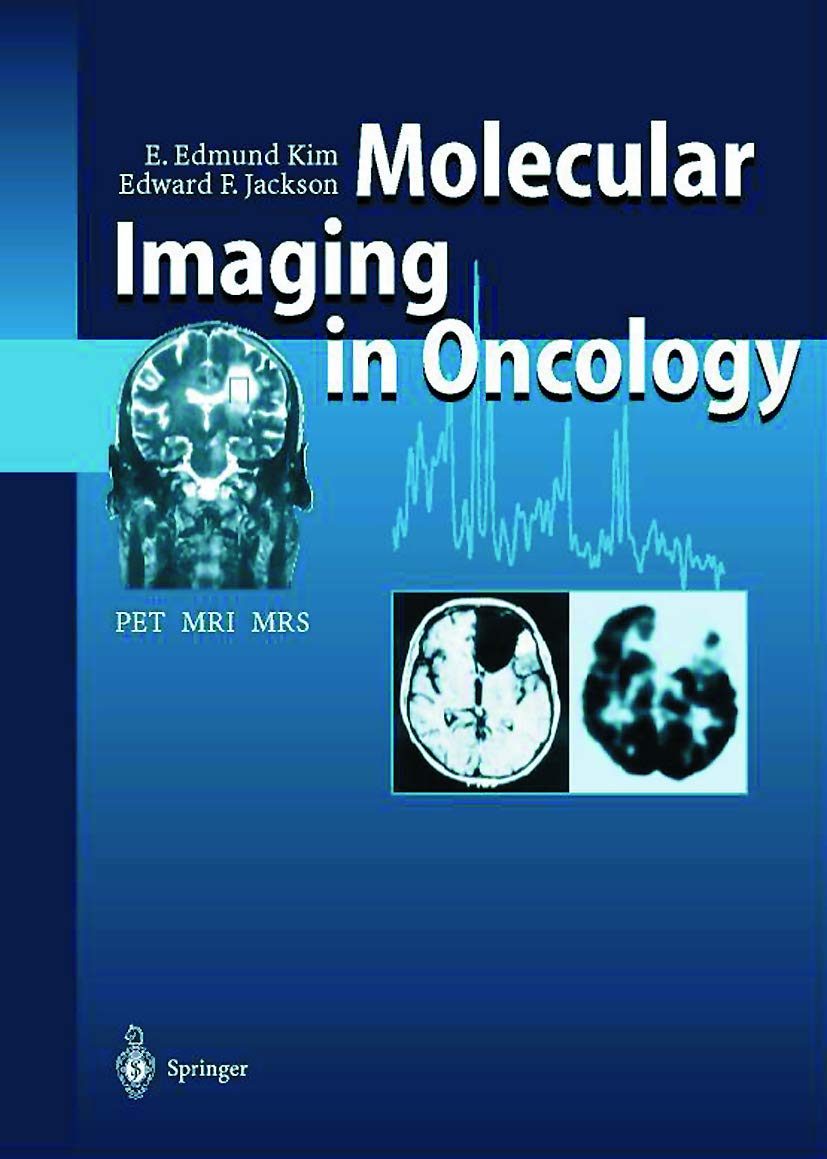 Molecular Imaging in Oncology - Retail Maharaj