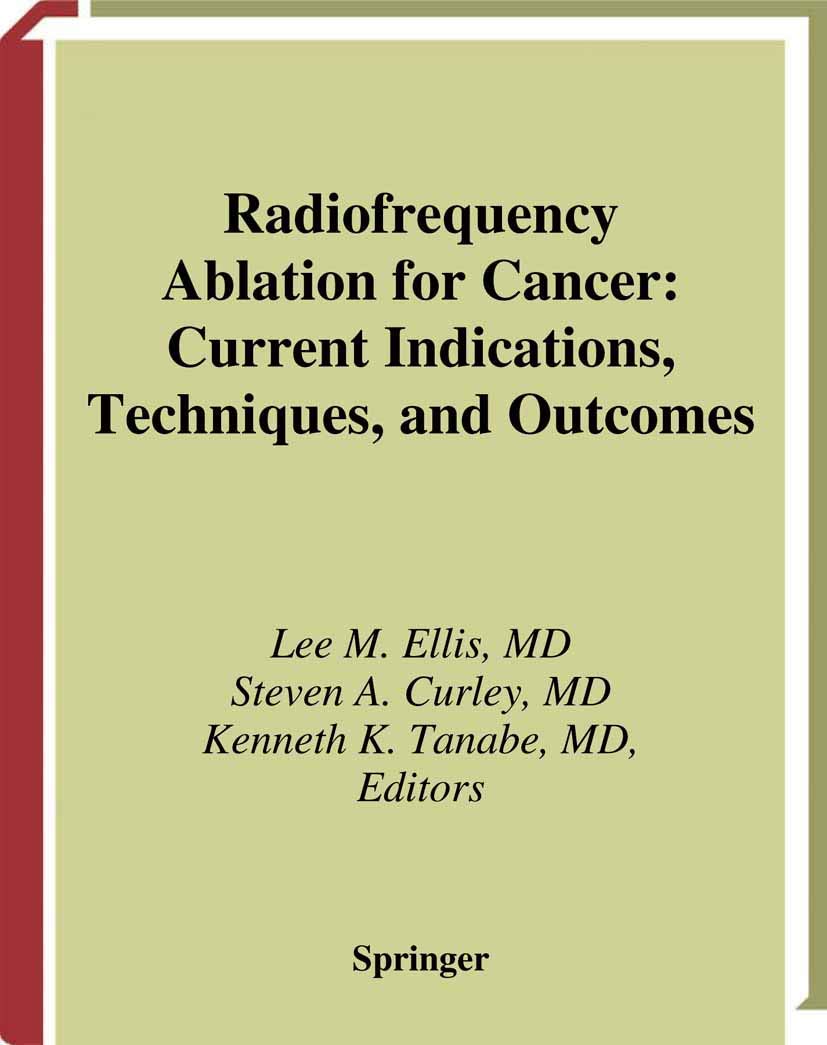 Radiofrequency Ablation for Cancer: Current Indications, Techniques, and Outcomes - Retail Maharaj