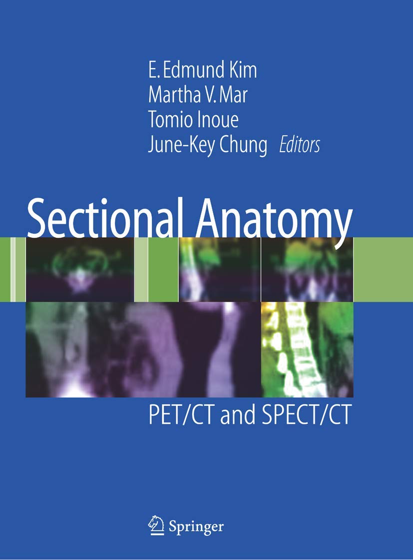 Sectional Anatomy: PET/CT and SPECT/CT - Retail Maharaj