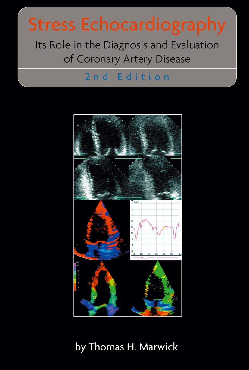 STRESS ECHOCARDIOGRAPHY: Its Role in the Diagnosis and Evaluation of Coronary Artery Disease: 247 (Developments in Cardiovascular Medicine) - Retail Maharaj