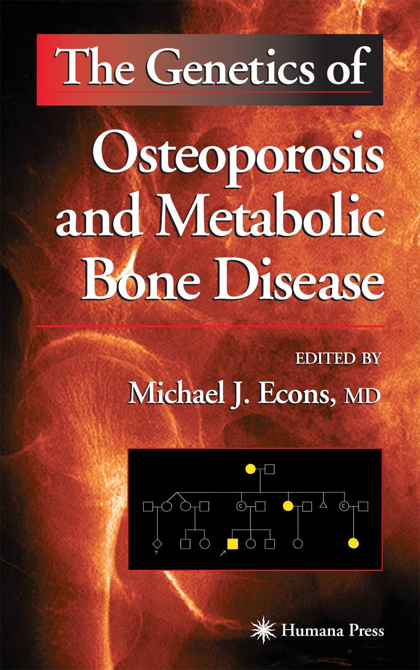 The Genetics of Osteoporosis and Metabolic Bone Disease - Retail Maharaj