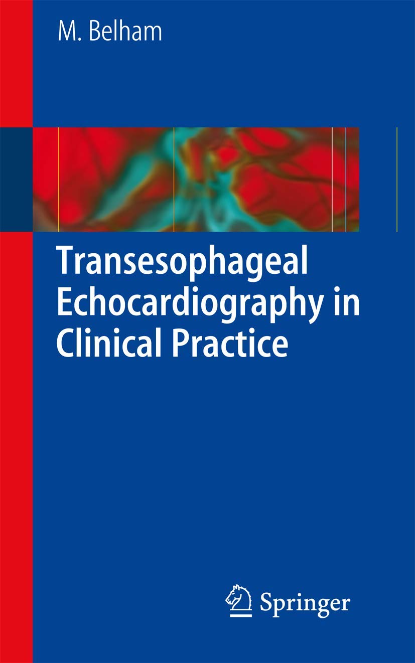Transesophageal Echocardiography in Clinical Practice - Retail Maharaj